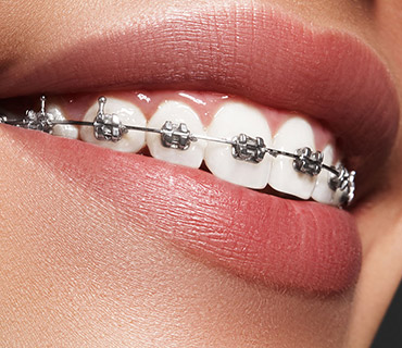 Ortodonti, ağız ve çene cerrahisi