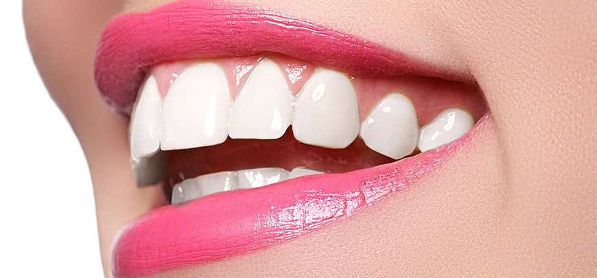 Diş Beyazlatma, Kozmetik Diş Hekimliği, Gülüş Tasarımı Eskişehir